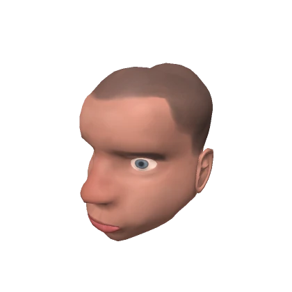 Tyler1 Head Dent