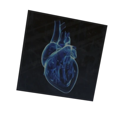 Heart Xray Scan