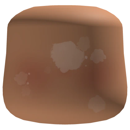 Faceless Vitiligo Blush Cheeks Head Nougat Skin