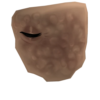 Tissue Scar